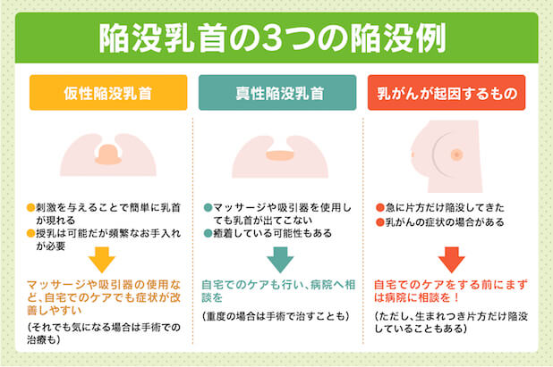 1万回いじると乳首は取れる :: デイリーポータルZ