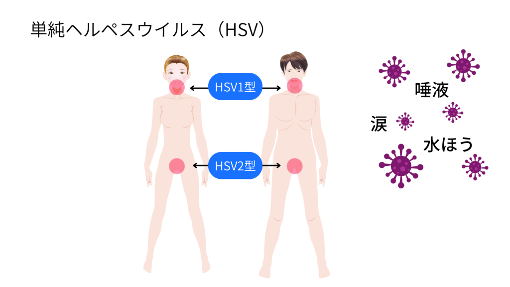 性病エッチしてない】セックスなしでもお風呂、トイレから感染する性病まとめ – サコダ・レディースクリニック