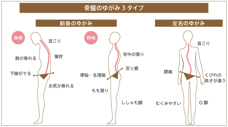 盛りマンとは？魅力やメリット、気になる改善方法も3つご紹介！｜駅ちか！風俗雑記帳