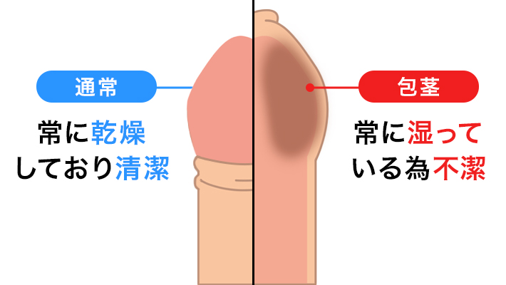 あの『ペニスの形』には意味があるの？ちんこの亀頭があの形の理由【ラブコスメ】