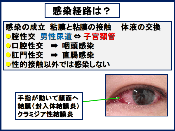 性病検査(クラミジア・淋菌)｜各務原市の婦人科は東海内科・内視鏡クリニック 岐阜各務原院