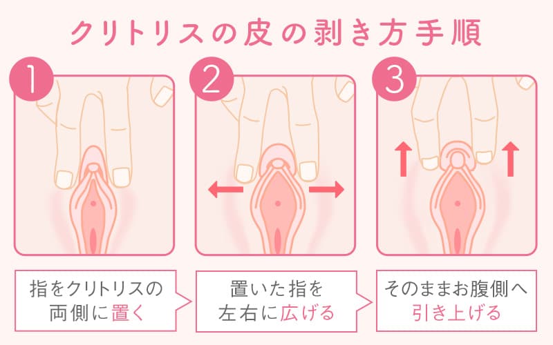 クリトリス包茎 | 診療案内