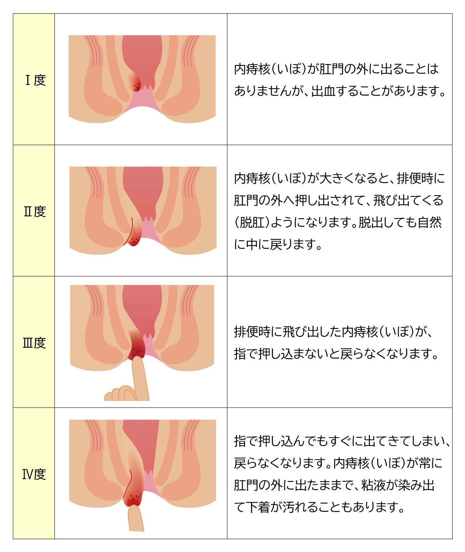 縦割れアナルの原因と開発方法】男性の方が女性よりなりやすい！？｜風じゃマガジン