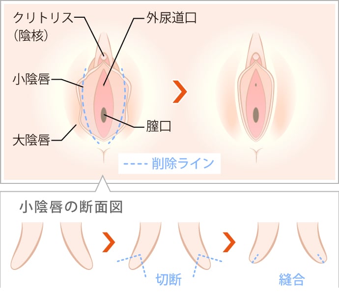 ウーマナイザー プレミアム |