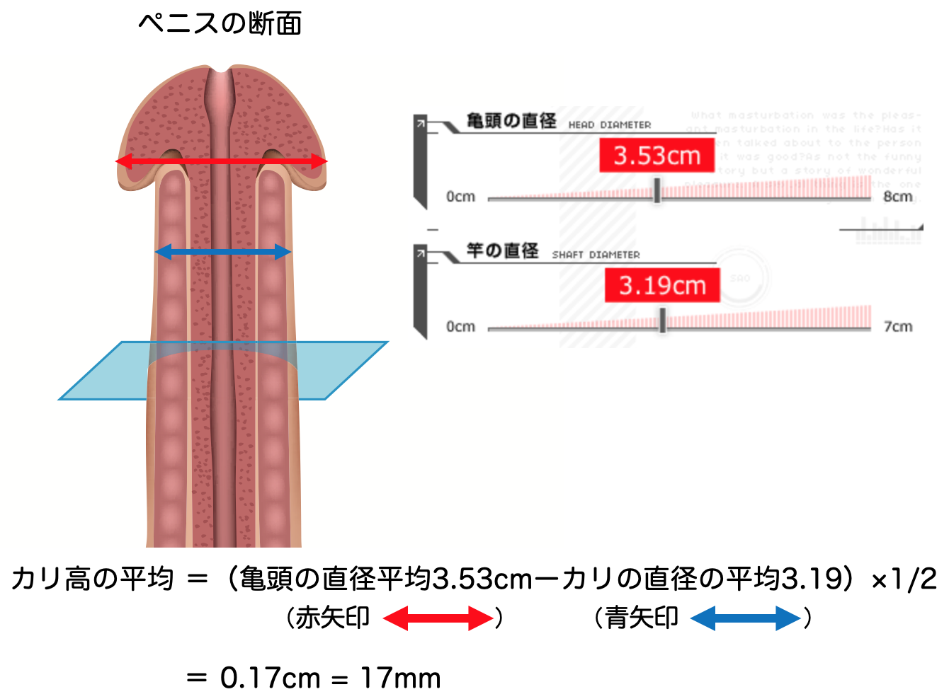 勃起を監視するコンドーム型デバイス ペニスの長さと円周を測定、遠隔医療に活用：Innovative Tech（2/2 ページ） -