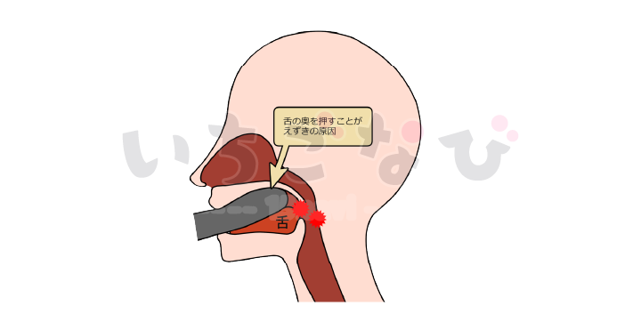 莉久 集団暴行 押さえつけられて 苦しい姿勢で