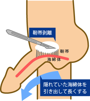 図録▽ペニス・サイズの国際比較