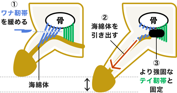 短小包茎とは！短小は何センチから？日本人の平均サイズや治療法 - アトムクリニック -