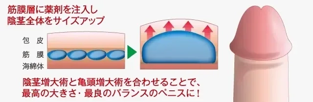 でかいちんこの基準とは？日本人平均や大きくする方法を解説 |【公式】ユナイテッドクリニック