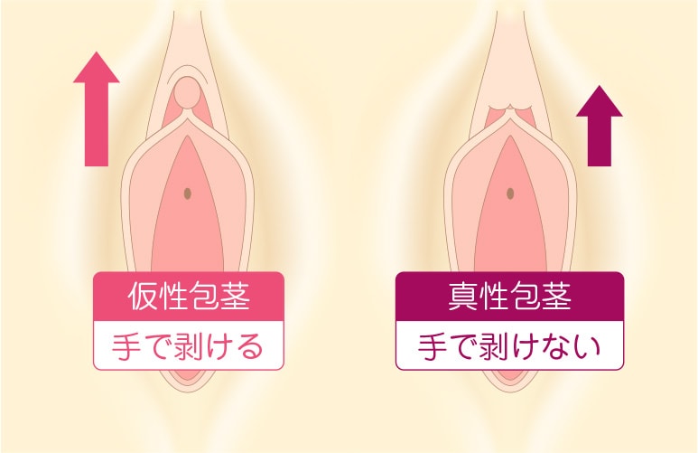 極上オホ声の実演オナニー】『クリトリス取れちゃうぅ〜！オホォ〜〜！！』クリトリス吸引おもちゃでヤバイおほ声出しながら連続絶頂！！(実演オホ声) -  FANZA同人