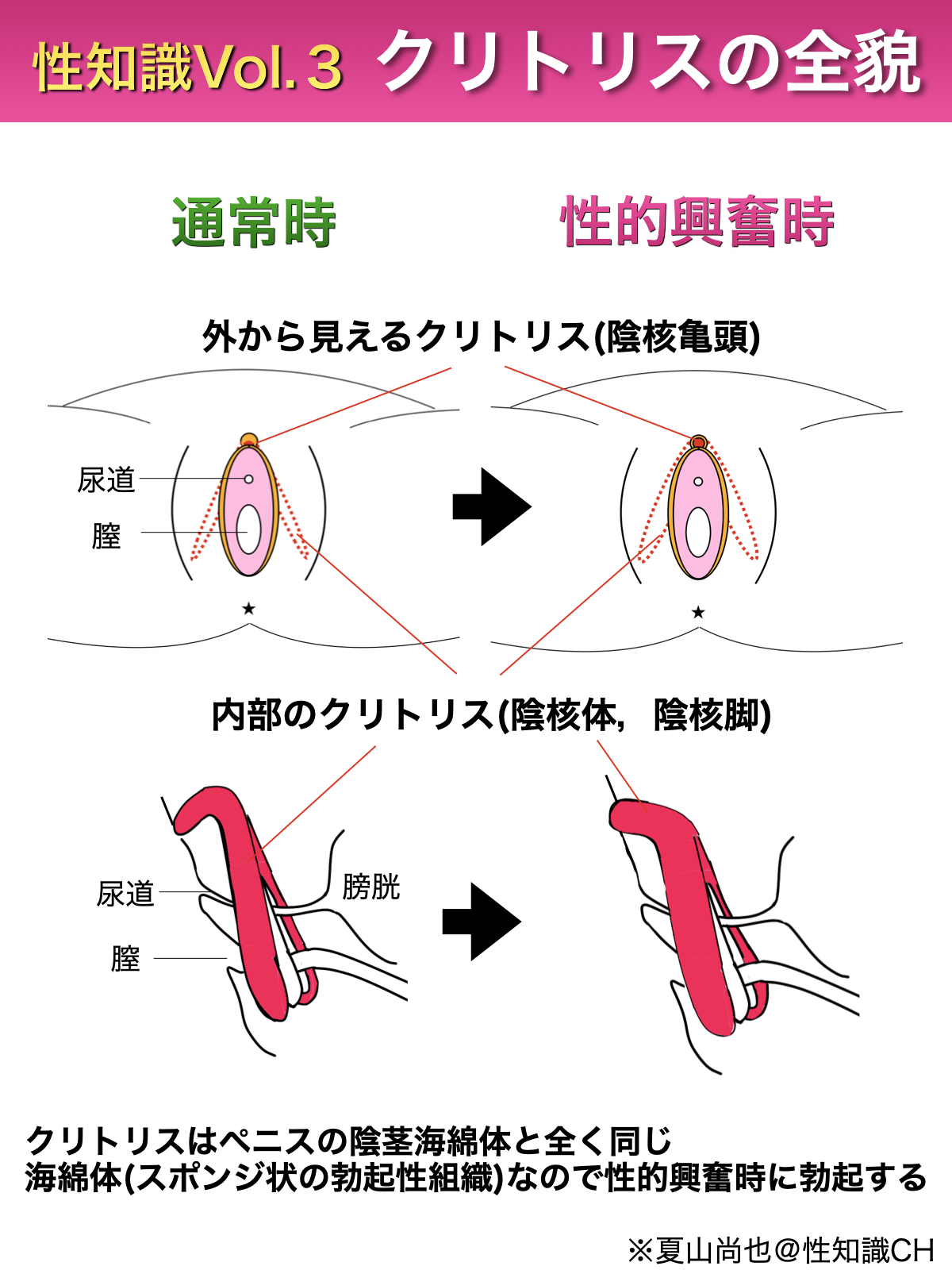 勃起したクリトリス, 巨大なクリトリス, ラクダのつま先,