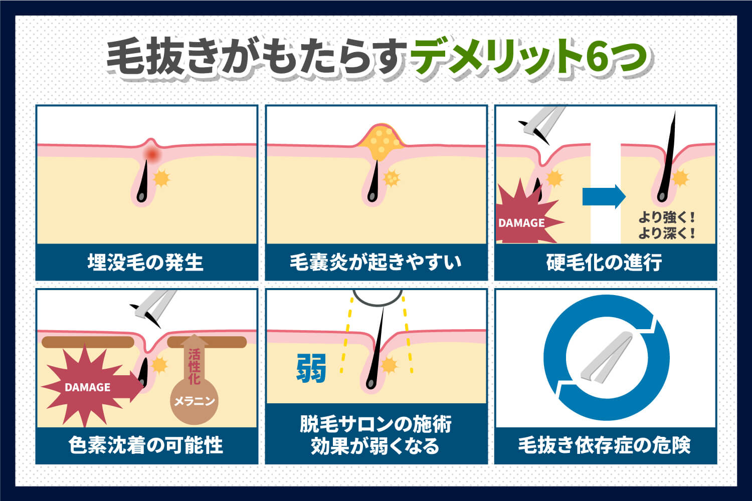 脱毛後の毛抜きはNG！毛が抜けるまでの期間やお手入方法を解説 | メンズ脱毛百科事典 リンクスペディア