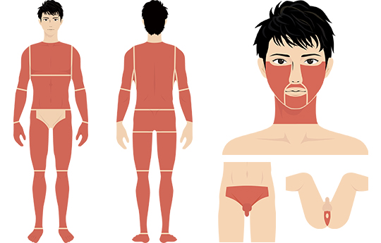 メンズ脱毛｜神戸・明石・垂水で最新ジェントルのつかもと形成外科｜三宮