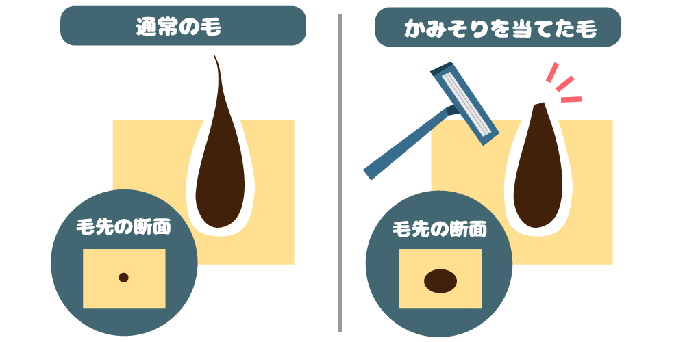 パイチンは女性ウケ抜群！男性が陰毛処理するメリットを解説【医師監修】 | 新橋ファーストクリニック【公式】