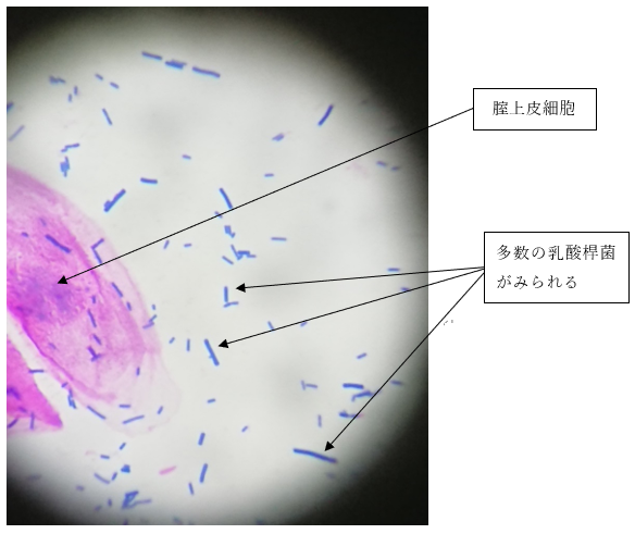 イカ臭い原因！？これが謎の病気、細菌性腟症だ！！ | 医療法人社団 予防会