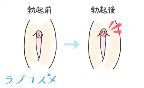 クリトリスの勃起前と勃起後 - 真性クリトリス包茎 マンコ オメコ