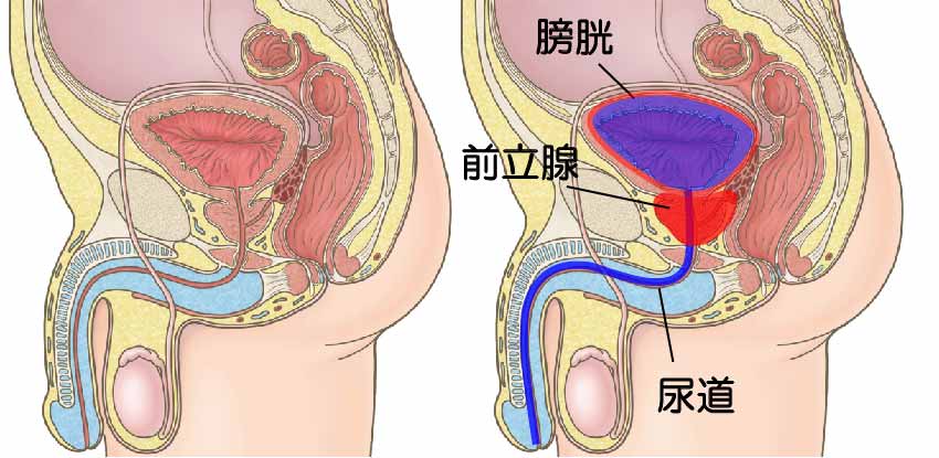 前立腺とは？｜前立腺がんについて｜What's? 前立腺がん