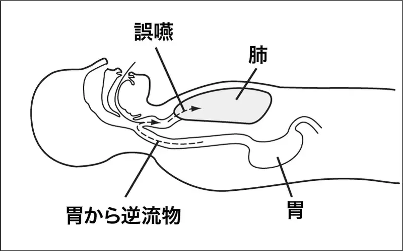 回復体位 とは？普段どおりの呼吸はあるけど意識がない！救急車を待つ間にできること｜AED（自動体外式除細動器）サービス（レンタル）｜医療サービス｜法人向けセキュリティ対策・防犯対策のセコム