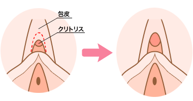 クリトリスの皮は剥いて舐めるべき？正しい剥き方と絶頂間違いなしの方法を伝授！ | happy-travel[ハッピートラベル]