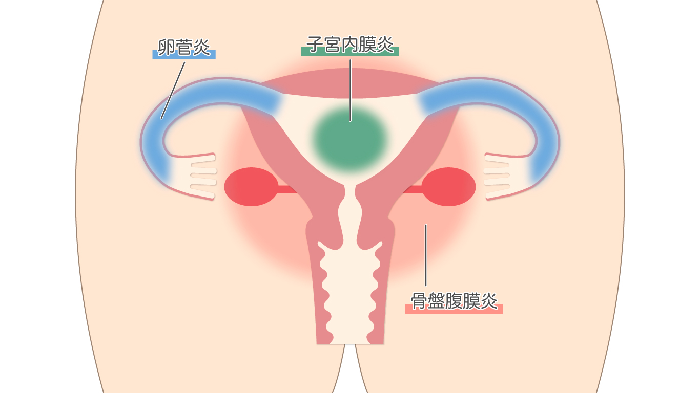 女性器やおりものの臭い（匂い）で分かる原因や性病の種類とは？