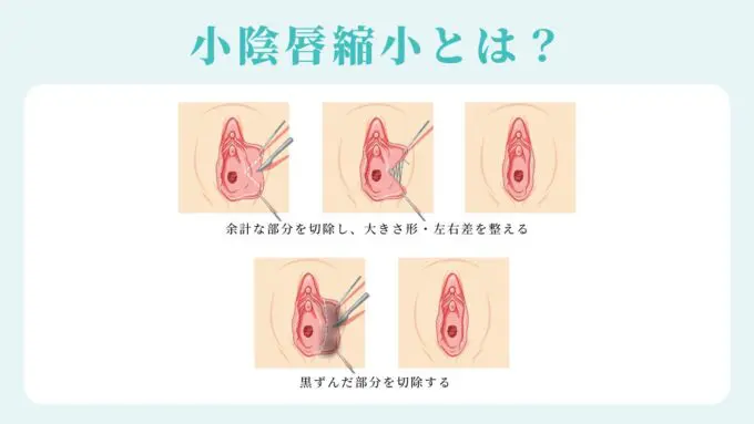 クリトリスは女性がもっとも感じやすい性感帯！クリトリスのイロハを学んで“クリイキ”の虜に！ | 日刊SODオンライン