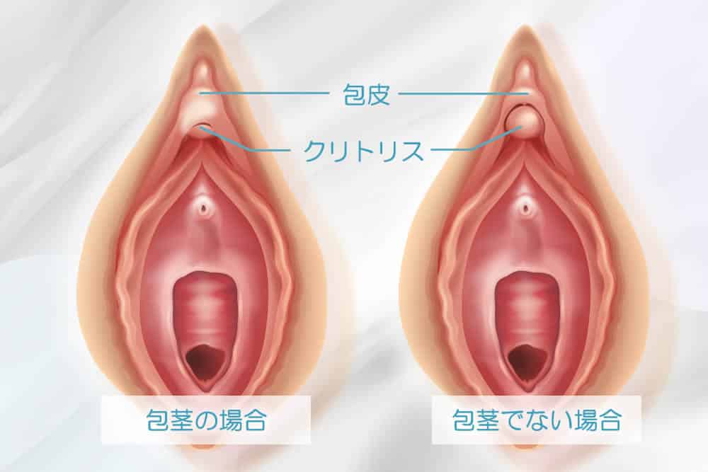 クリトリスを剥く！安全なクリトリスの皮の剥き方とは？ | HIME