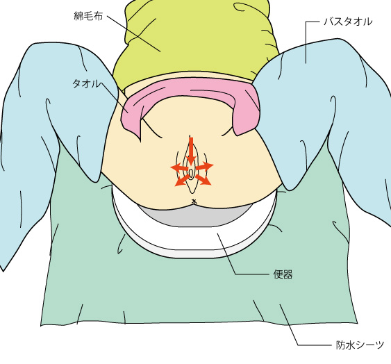 オムツ交換は1日何回？介護で大変なオムツ交換を便利グッズで楽にしよう | エルターレ介護