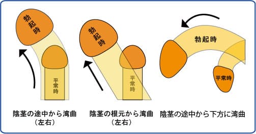 Amazon.co.jp: 「『おばさんで本当にいいの?』若くて硬い勃起角度150度の少年チ○ポに抱きつかれた看護師はヤられても本当は嫌じゃない」VOL.5+総勢27人総集編付き  豪華版