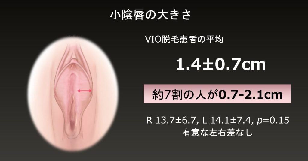 小陰唇が大きい理由について原因と対策を医師が解説【症例写真つき】｜スワンクリニック銀座