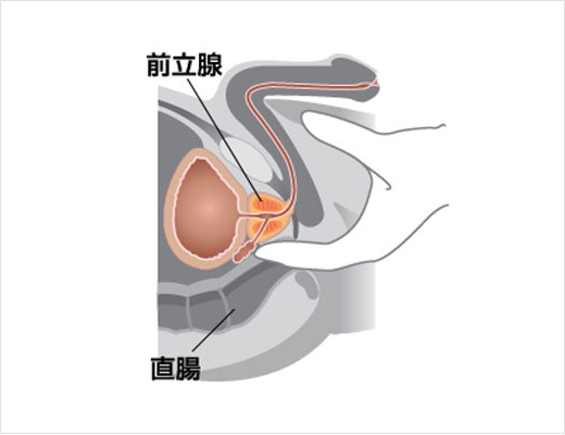 前立腺肥大症 | いまもと泌尿器科クリニック