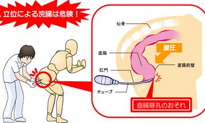 初心者向けアナルセックスのやり方教えます