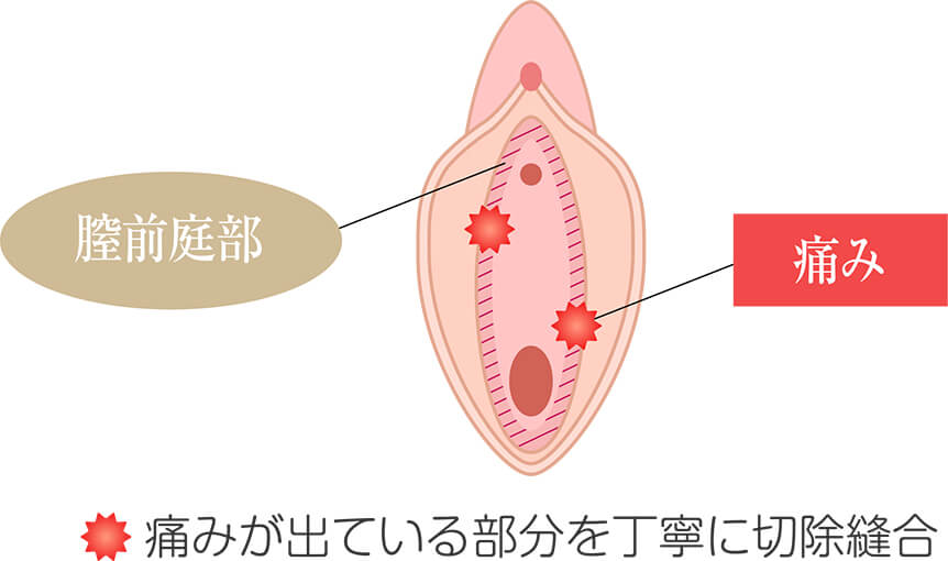 まんこ（女性器）の７つの性感帯攻略マニュアル | セクテクサイト