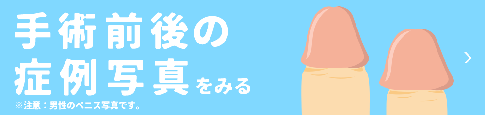 亀頭増大・陰茎増大・ペニスを大きく（太く）｜岡山中央クリニック（公式サイト）