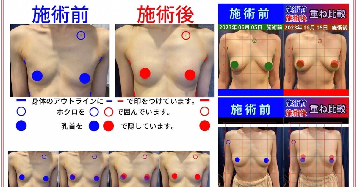 野谷葉月が教える本当のバストアップ：科学的根拠と誤解の解消｜エステ豊胸研究家🍀葉月先生