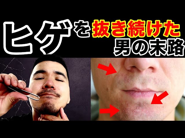 ヒゲは剃るほうがいい？抜くほうがいい？おすすめの方法とは？ - 【公式】メンズトータルエステサロン ZELMO(ゼルモ)