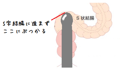 ズプズプゴリゴリッッ!!!!怒涛の二本結腸責めを見よ♥独占欲溢れる調教ラブをチラ見せ！｜BLニュース ちるちる