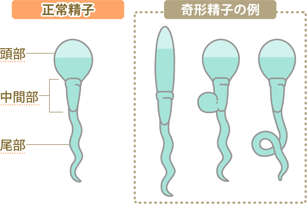 我慢汁の増やし方とは？我慢汁の正体・出ない原因・増やすメリットを解説 | ザヘルプM