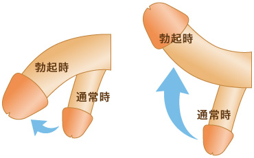 反りチンとは？反り方の違いやおすすめの体位も解説！｜風じゃマガジン