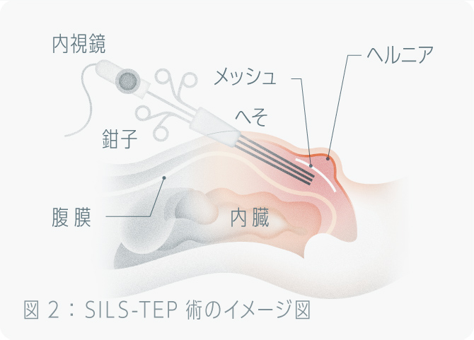 鼠径部マッサージ 人気記事（一般）｜アメーバブログ（アメブロ）