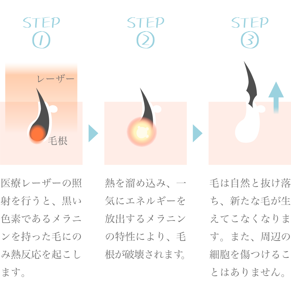 睾丸（玉袋）周辺の毛は処理すべき？メリットやデメリット、根本的な解決方法も解説│メンズジェニー