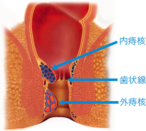 よくわかる基礎知識｜透析患者さんの合併症：感染症 | 家族と考える慢性腎臓病サイト