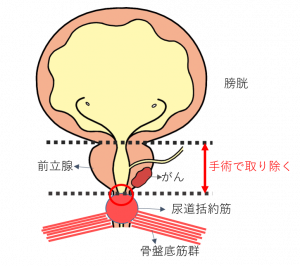 前立腺がんの薬物療法 | 順天堂大学・順天堂医院泌尿器科