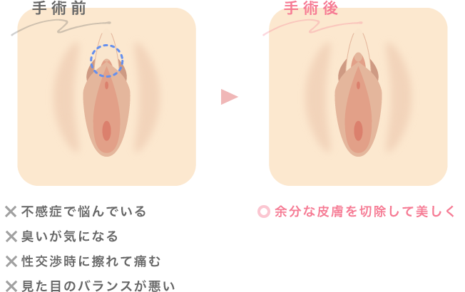 クリトリス構造をAV女優と一緒に医学的観点から解説 – メンズ形成外科 |